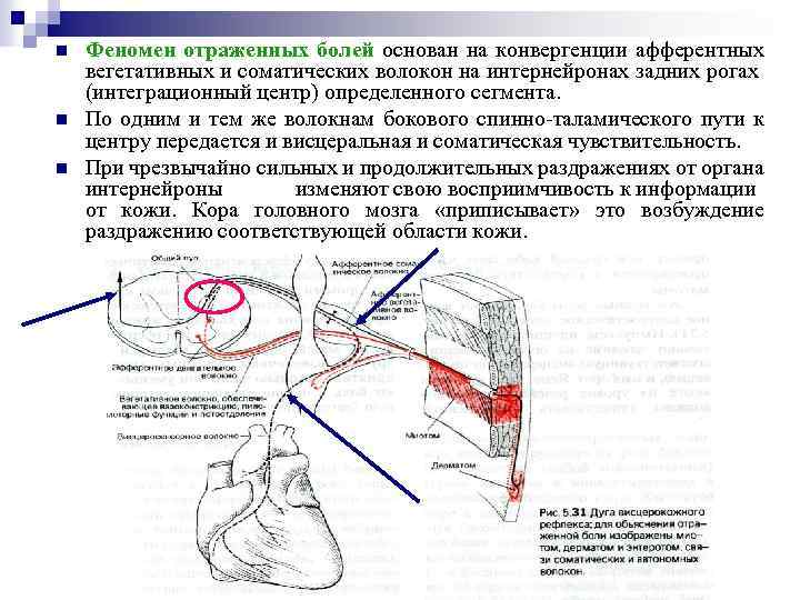 n n n Феномен отраженных болей основан на конвергенции афферентных вегетативных и соматических волокон