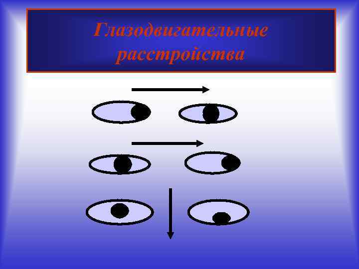 Глазодвигательные расстройства 