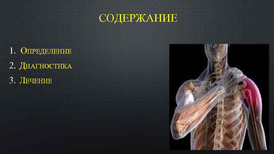 СОДЕРЖАНИЕ 1. ОПРЕДЕЛЕНИЕ 2. ДИАГНОСТИКА 3. ЛЕЧЕНИЕ 