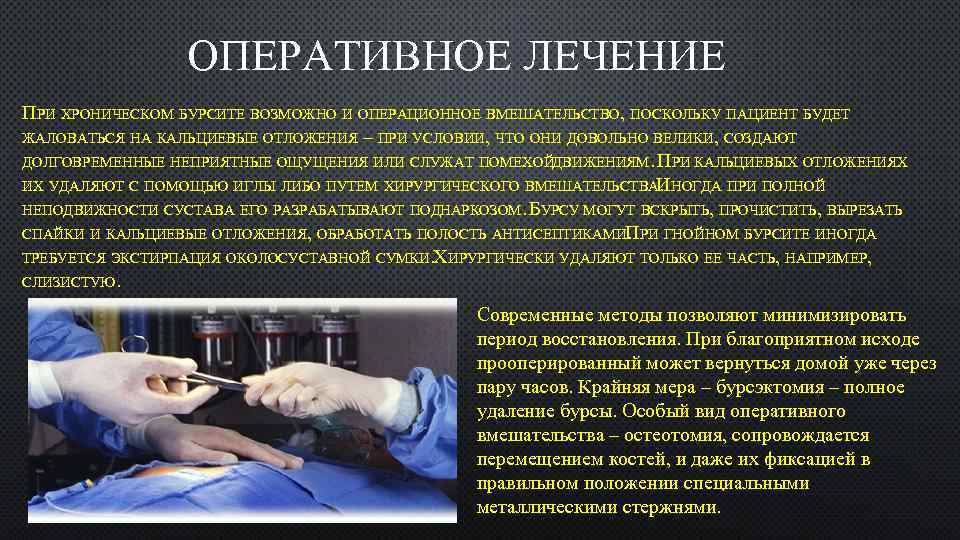 ОПЕРАТИВНОЕ ЛЕЧЕНИЕ ПРИ ХРОНИЧЕСКОМ БУРСИТЕ ВОЗМОЖНО И ОПЕРАЦИОННОЕ ВМЕШАТЕЛЬСТВО, ПОСКОЛЬКУ ПАЦИЕНТ БУДЕТ ЖАЛОВАТЬСЯ НА