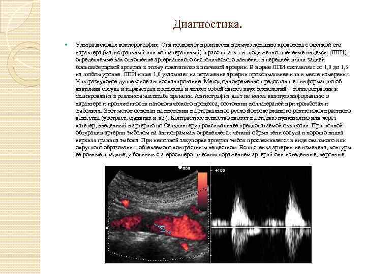 Диагностика. Ультразвуковая доплерография. Она позволяет произвести прямую локацию кровотока с оценкой его характера (магистральный