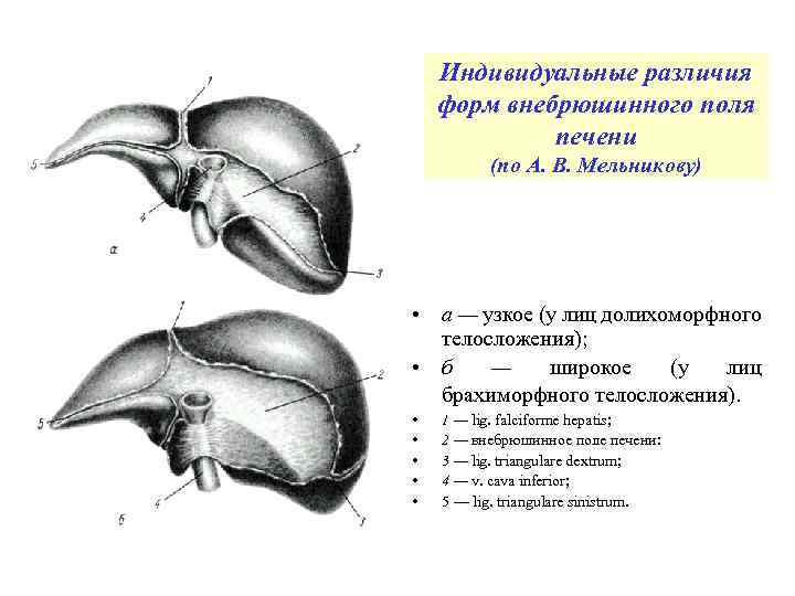Индивидуальные различия форм внебрюшинного поля печени (по А. В. Мельникову) • а — узкое