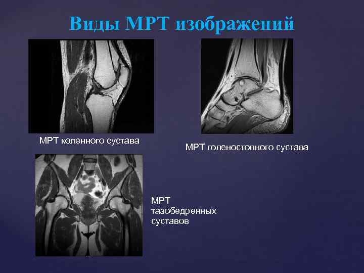Виды МРТ изображений МРТ коленного сустава МРТ голеностопного сустава МРТ тазобедренных суставов 