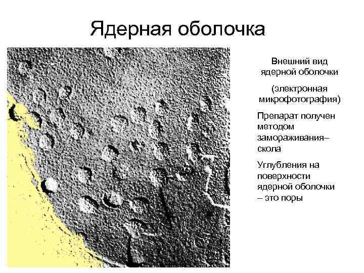 Ядерная оболочка Внешний вид ядерной оболочки (электронная микрофотография) Препарат получен методом замораживания– скола Углубления