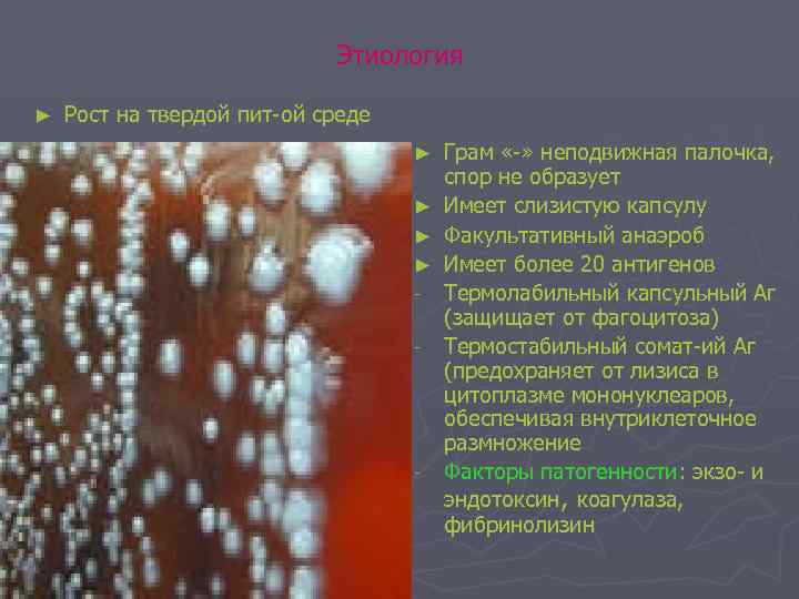 Этиология ► Рост на твердой пит-ой среде Грам «-» неподвижная палочка, спор не образует