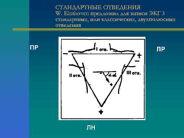 СТАНДАРТНЫЕ ОТВЕДЕНИЯ W. Einthovcn предложил для записи ЭКГ 3 стандартных, или классических, двухполюсных отведения
