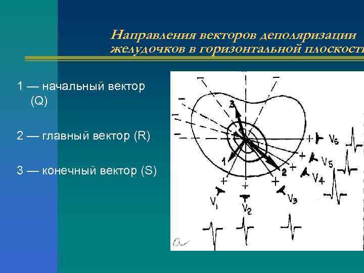 Направления векторов деполяризации желудочков в горизонтальной плоскости 1 — начальный вектор (Q) 2 —