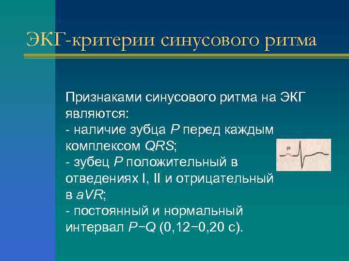 ЭКГ-критерии синусового ритма Признаками синусового ритма на ЭКГ являются: - наличие зубца Р перед