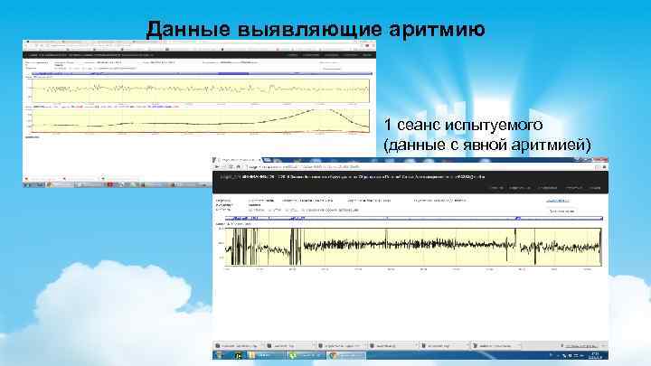 Данные выявляющие аритмию 1 сеанс испытуемого (данные с явной аритмией) 