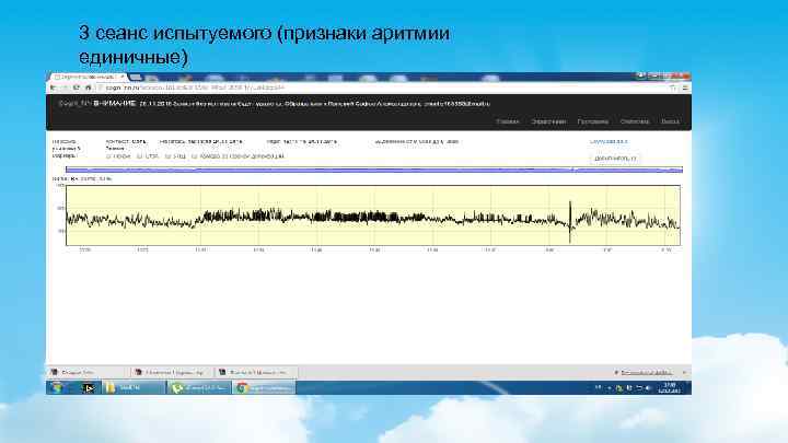 3 сеанс испытуемого (признаки аритмии единичные) 