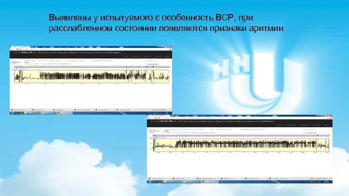 Выявлены у испытуемого с особенность ВСР, при расслабленном состоянии появляются признаки аритмии 