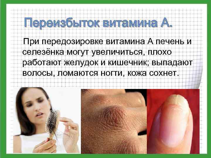 Переизбыток витамина А. При передозировке витамина А печень и селезёнка могут увеличиться, плохо работают