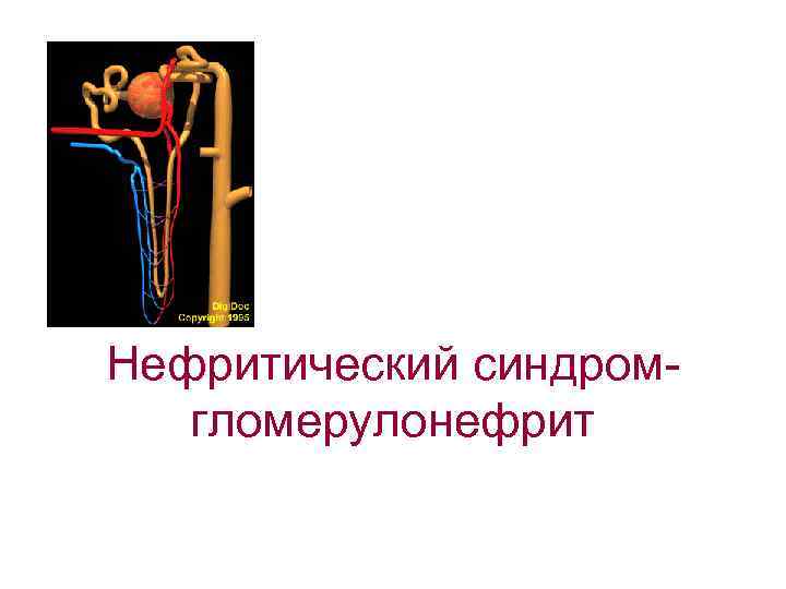 Нефритический синдромгломерулонефрит 