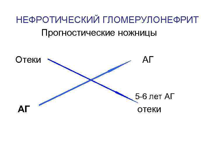 НЕФРОТИЧЕСКИЙ ГЛОМЕРУЛОНЕФРИТ Прогностические ножницы Отеки АГ 5 -6 лет АГ отеки 