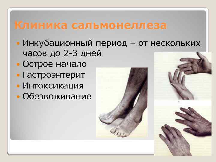 Клиника сальмонеллеза Инкубационный период – от нескольких часов до 2 -3 дней Острое начало