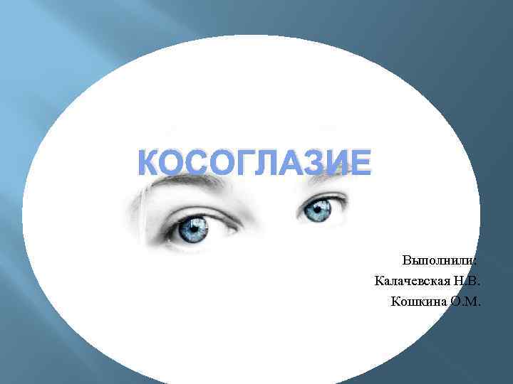 КОСОГЛАЗИЕ Выполнили: Калачевская Н. В. Кошкина О. М. 