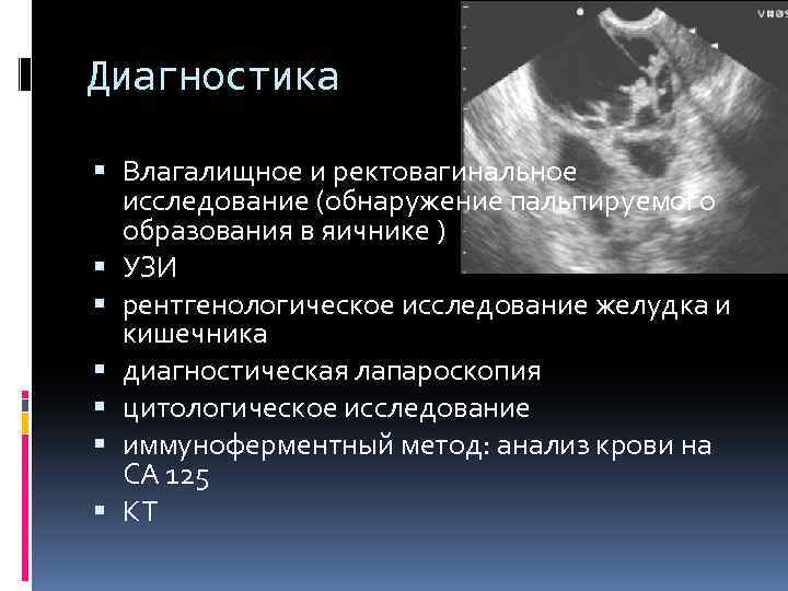 Диагностика Влагалищное и ректовагинальное исследование (обнаружение пальпируемого образования в яичнике ) УЗИ рентгенологическое исследование