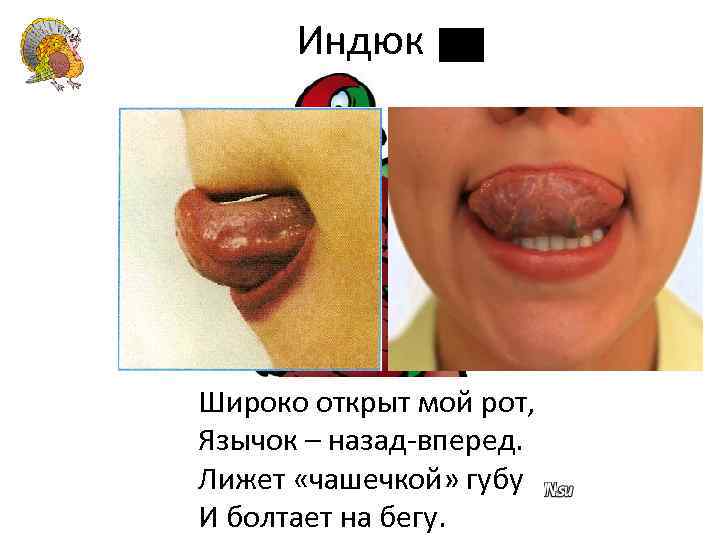 Индюк Широко открыт мой рот, Язычок – назад-вперед. Лижет «чашечкой» губу И болтает на