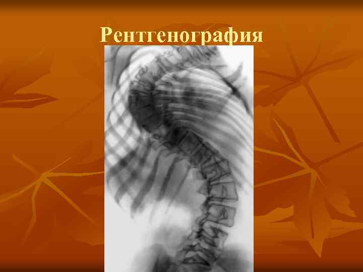 Рентгенография 