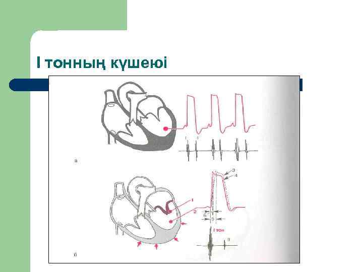 І тонның күшеюі 