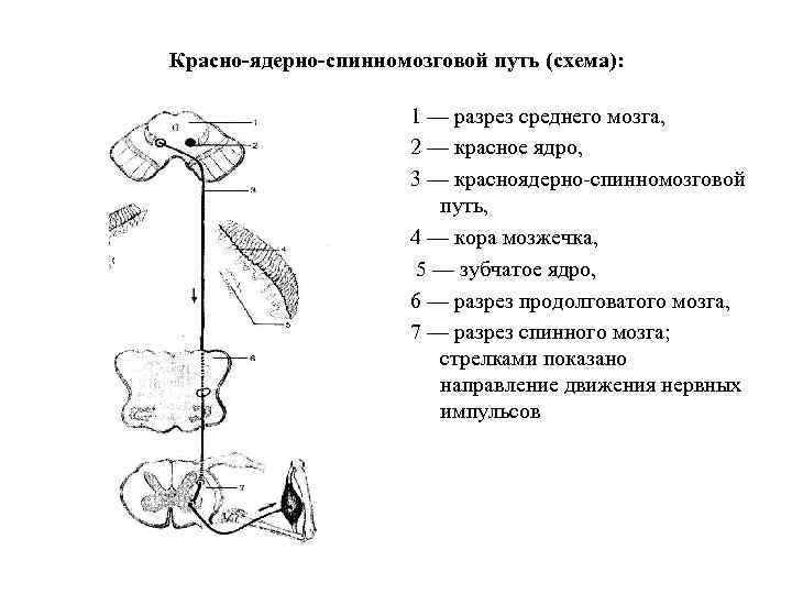 Красно-ядерно-спинномозговой путь (схема): 1 — разрез среднего мозга, 2 — красное ядро, 3 —