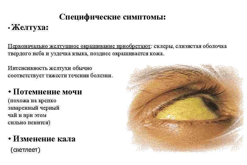 Специфические симптомы: • Желтуха: Первоначально желтушное окрашивание приобретают: склеры, слизистая оболочка твердого неба и