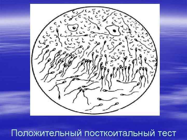 Положительный посткоитальный тест 