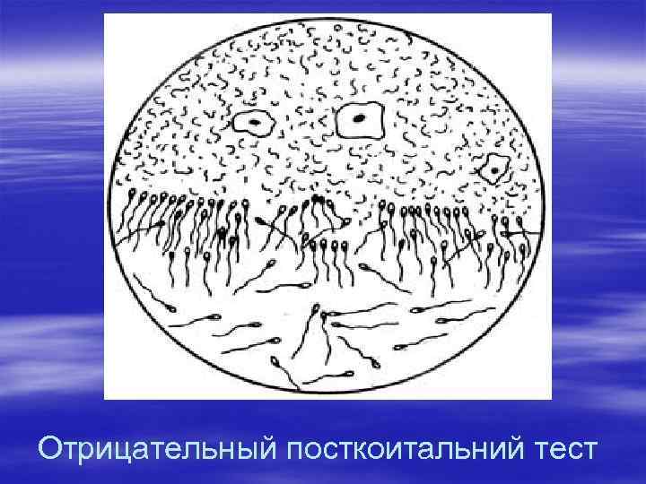 Отрицательный посткоитальний тест 