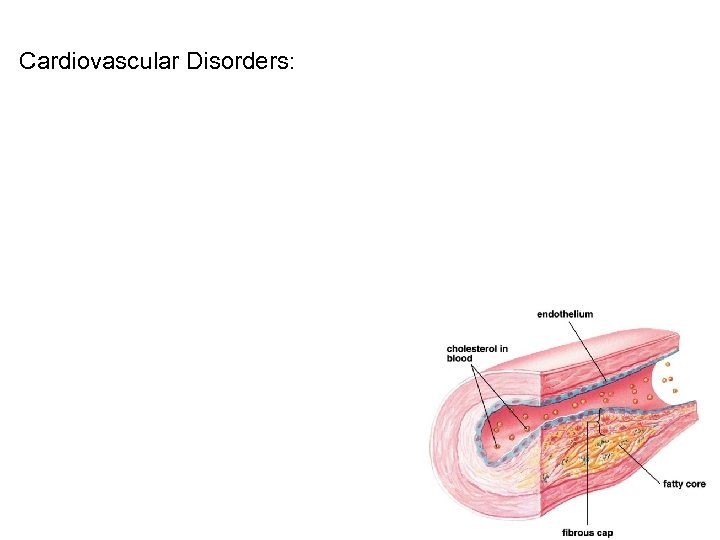 Cardiovascular Disorders: 