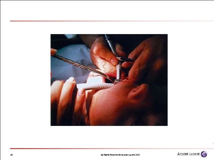 25 All Rights Reserved © Alcatel-Lucent 2007 