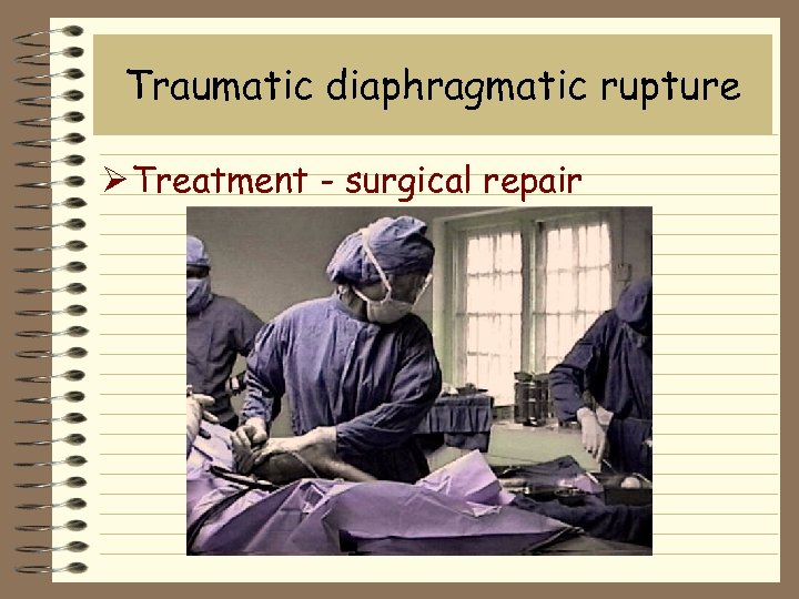 Traumatic diaphragmatic rupture Ø Treatment - surgical repair 