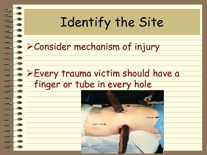 Identify the Site Ø Consider mechanism of injury Ø Every trauma victim should have