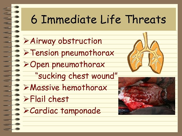 6 Immediate Life Threats Ø Airway obstruction Ø Tension pneumothorax Ø Open pneumothorax “sucking