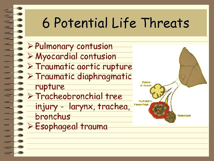 6 Potential Life Threats Ø Pulmonary contusion Ø Myocardial contusion Ø Traumatic aortic rupture