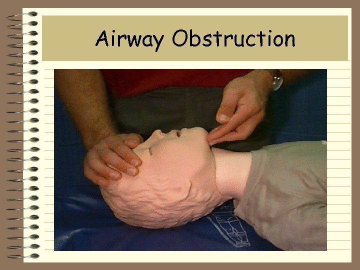 Airway Obstruction 