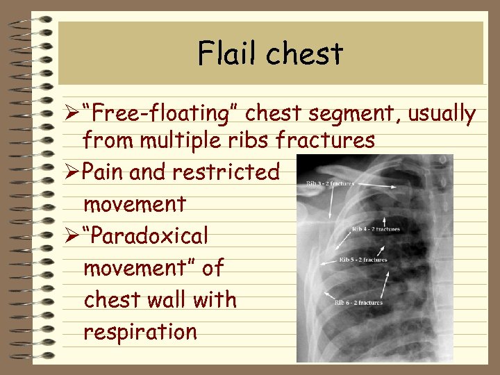 Flail chest Ø “Free-floating” chest segment, usually from multiple ribs fractures Ø Pain and