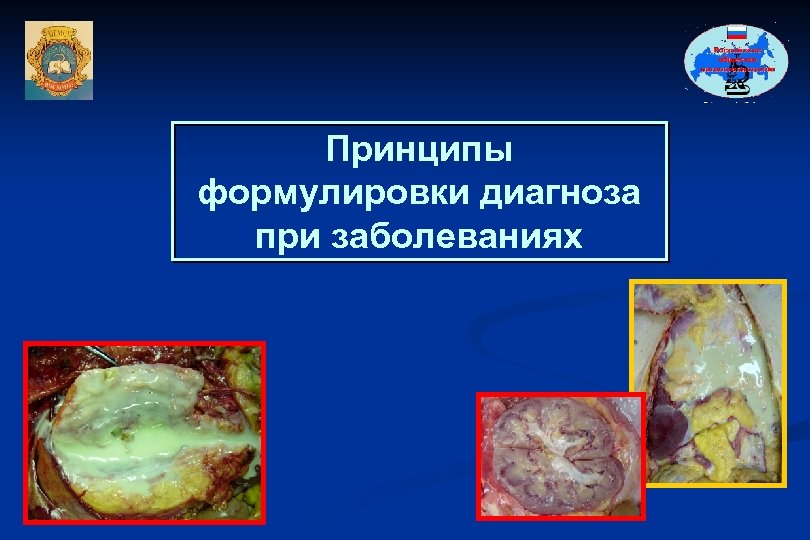 Принципы формулировки диагноза при заболеваниях 