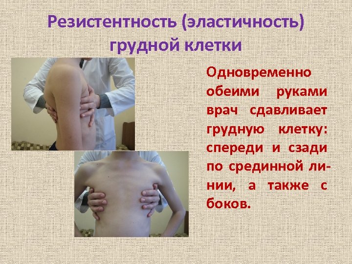 Резистентность (эластичность) грудной клетки Одновременно обеими руками врач сдавливает грудную клетку: спереди и сзади
