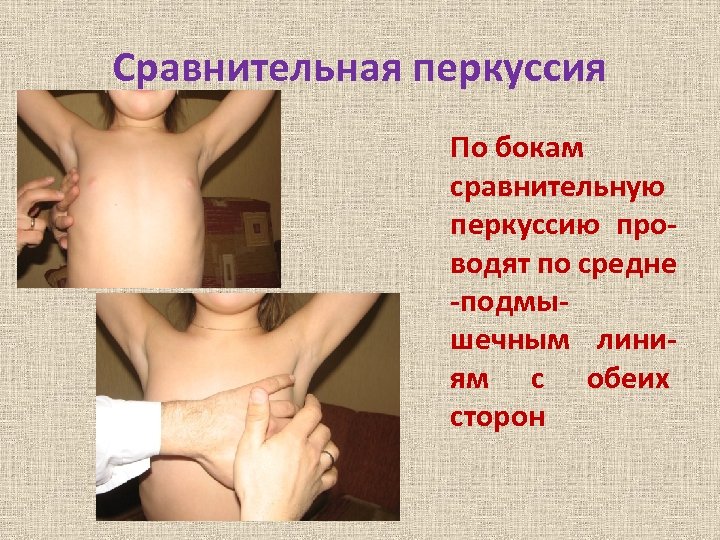 Сравнительная перкуссия По бокам сравнительную перкуссию проводят по средне -подмышечным линиям с обеих сторон