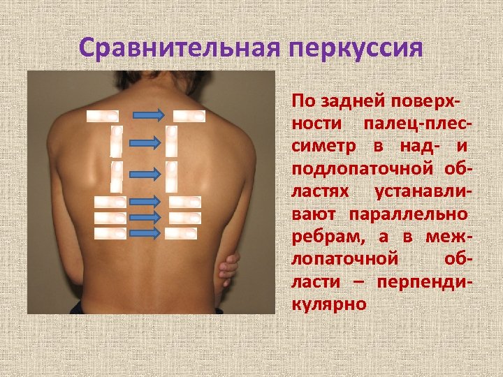 Сравнительная перкуссия По задней поверхности палец-плессиметр в над- и подлопаточной областях устанавливают параллельно ребрам,