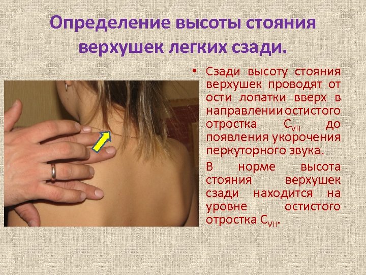 Определение высоты стояния верхушек легких сзади. • Сзади высоту стояния верхушек проводят от ости