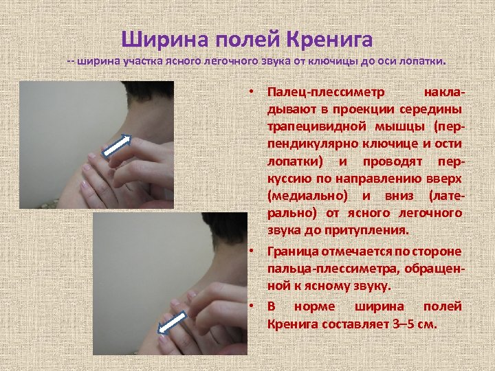 Ширина полей Кренига -- ширина участка ясного легочного звука от ключицы до оси лопатки.