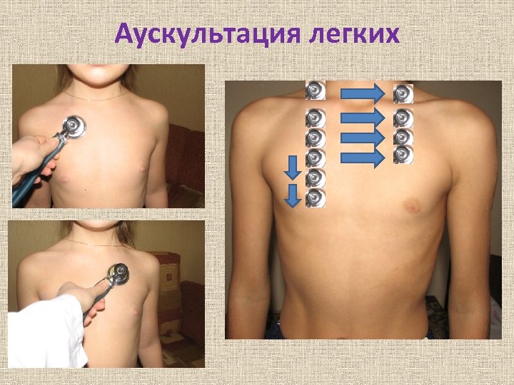 Аускультация легких 