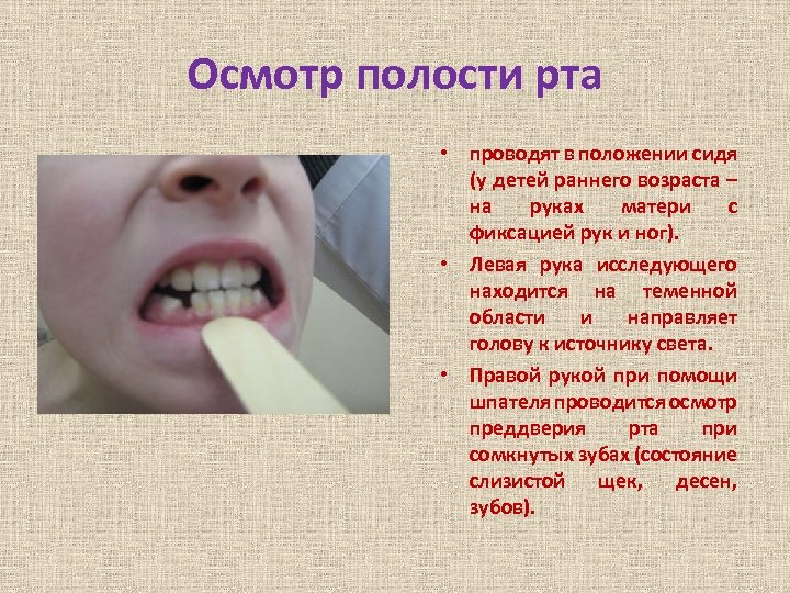 Осмотр полости рта • проводят в положении сидя (у детей раннего возраста – на