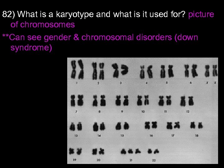 82) What is a karyotype and what is it used for? picture of chromosomes