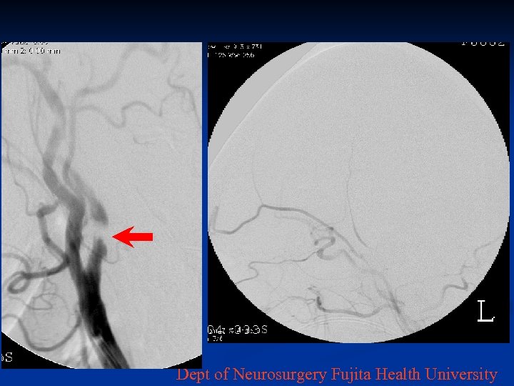 Dept of Neurosurgery Fujita Health University 