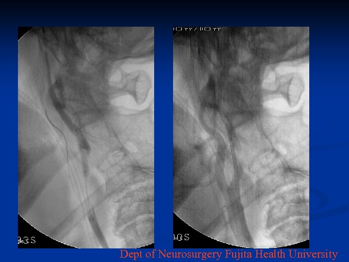 Dept of Neurosurgery Fujita Health University 