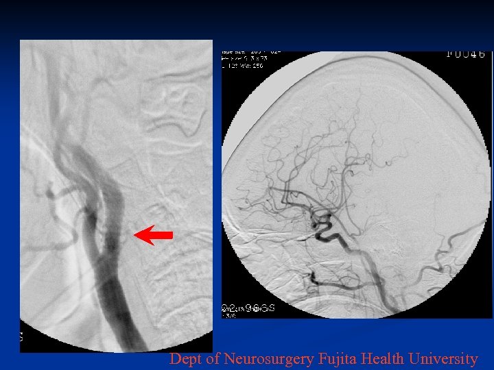 Dept of Neurosurgery Fujita Health University 