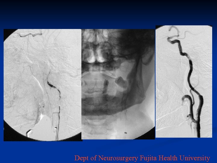 Dept of Neurosurgery Fujita Health University 