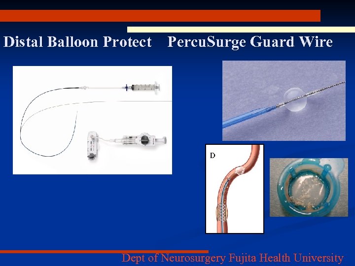 Distal Balloon Protect Percu. Surge Guard Wire Dept of Neurosurgery Fujita Health University 